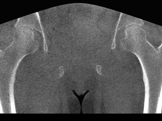 HiRise Female Hips