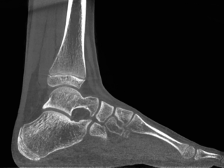 Pediatric Sagittal