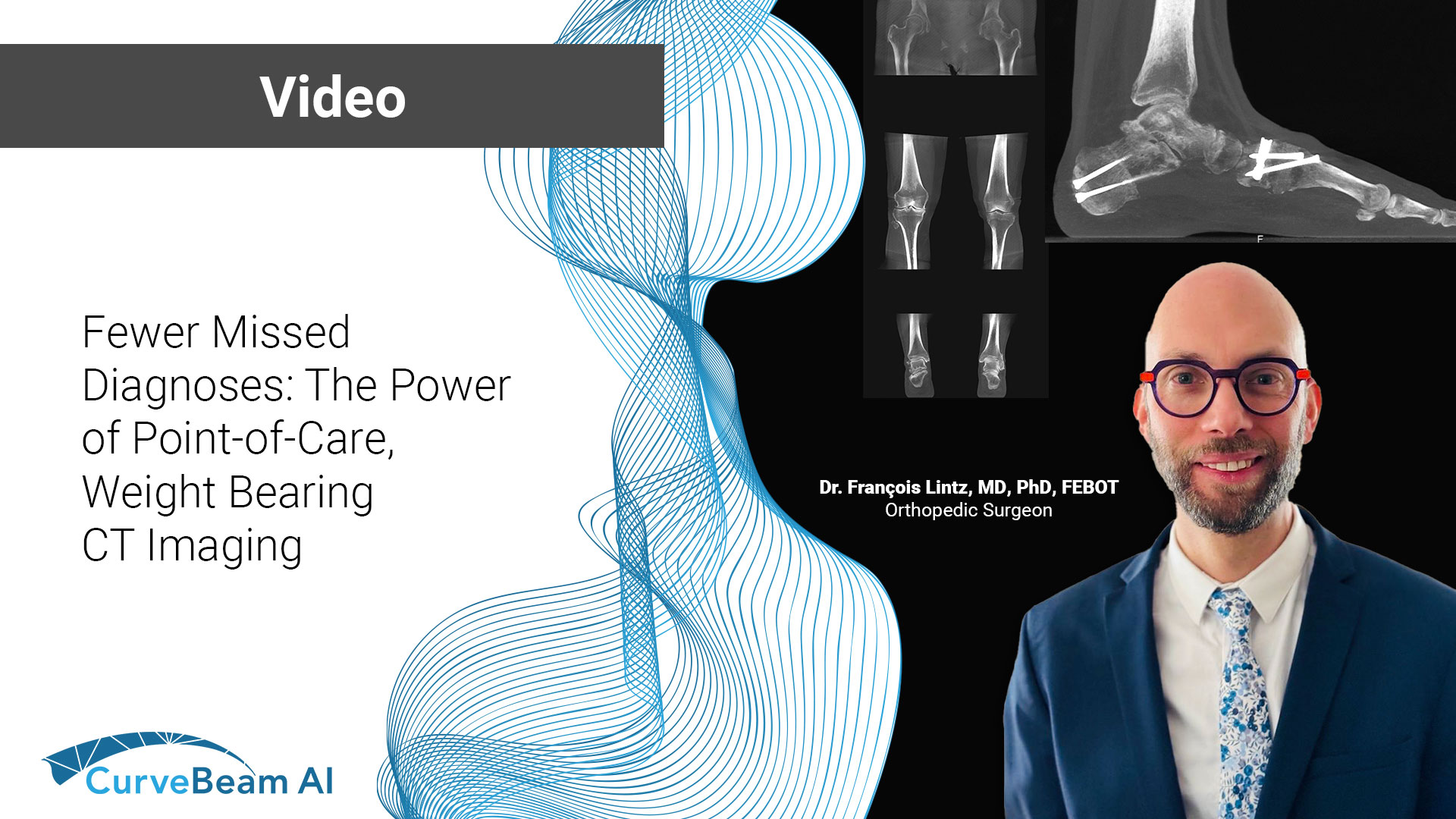 AAOS2025LintzBoothTalkVideo