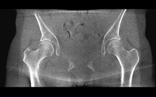 Female-Hip
